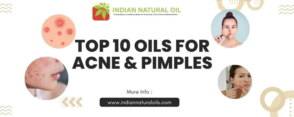 Top 10 Oils for Acne & Pimples Top 10 Oils for Acne & Pimples